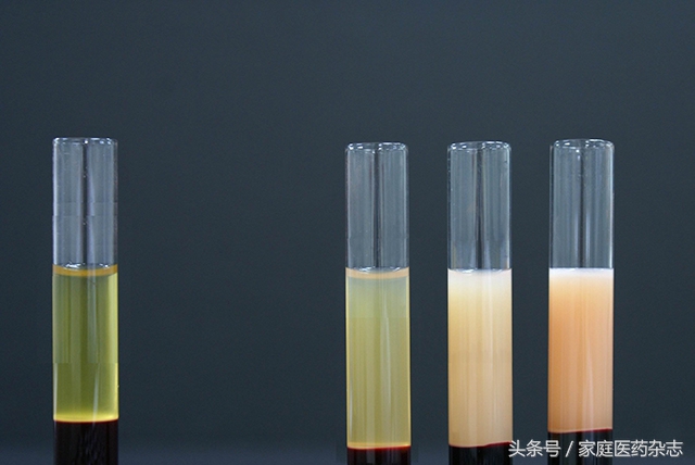 怎么清除血液中的脂肪,血液里面的脂肪要吃什么处理