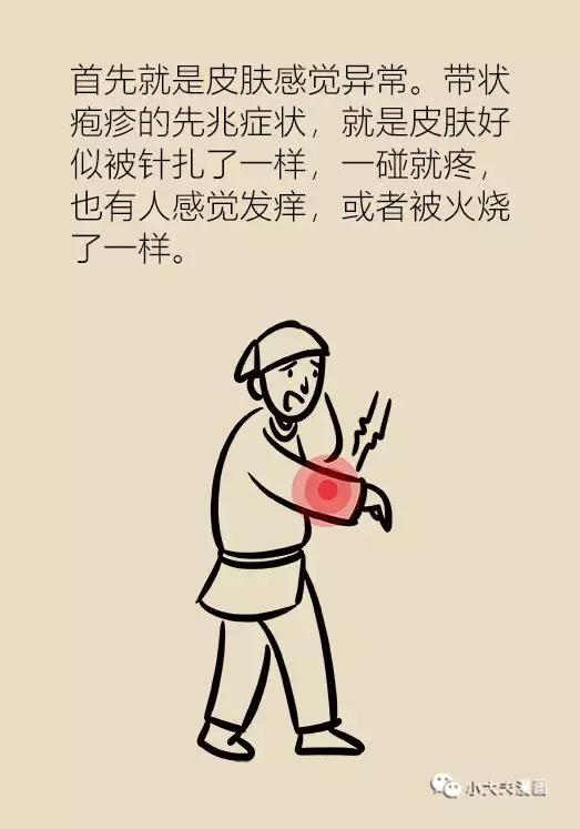 协和医院可以打带状疱疹疫苗吗,协和医院带状疱疹专家