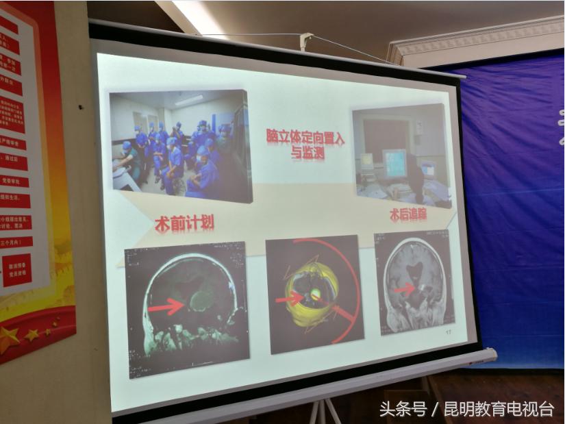 军海脑病,昆明军海脑科医院神经科