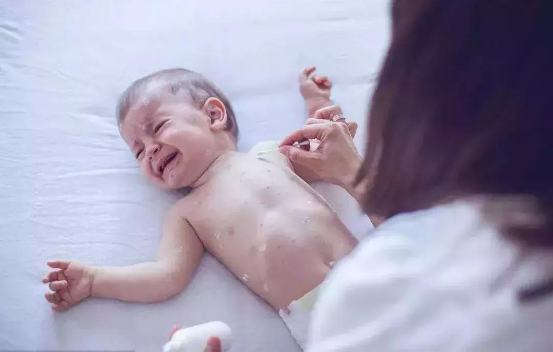 幼儿急疹猩红热水痘手足口鉴别,麻疹猩红热水痘手足口鉴别