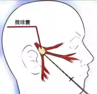 你的脸疼到不想要，神经外科专家却说：“十五分钟就能搞定”