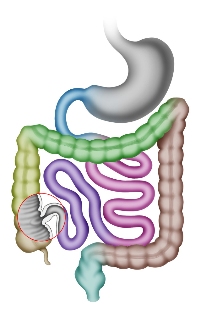 呼吸道感染最好的中成药,治疗呼吸道感染的特效药排名