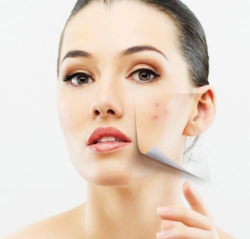 痘印痘痕怎么去除最有效的方法,痘印怎么快速消除最有效的办法