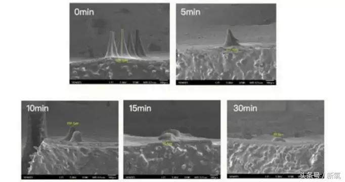治疗痘坑的微针品牌,家用抗皱美白祛斑微针