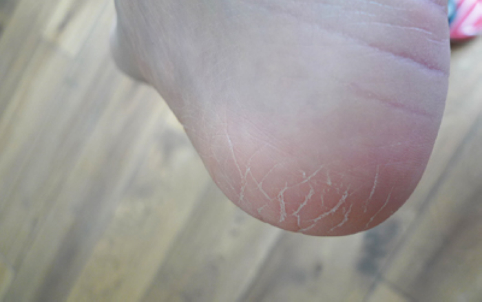 为什么天天洗脚还是很脏,为什么天天洗脚脚还是脱皮