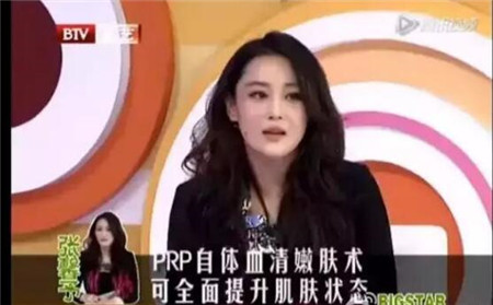 张雨绮解密超声刀,张雨绮吐槽微整超声刀