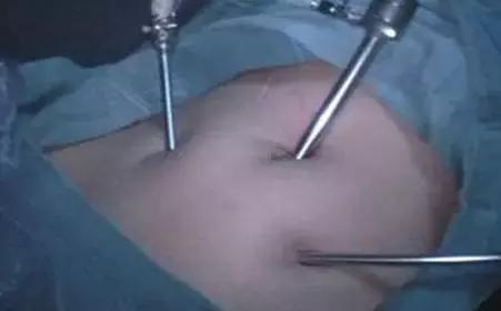 困扰人类的三大未解之谜,人类未解十大之谜的物体