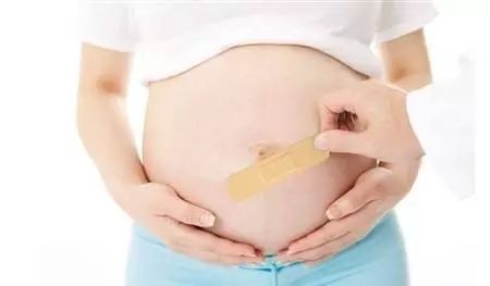 二胎疤痕妊娠产检,二胎如何避免妊娠疤痕
