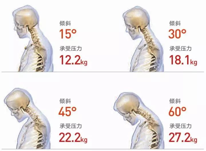 熬夜加班按摩,熬夜低头玩手机颈椎病