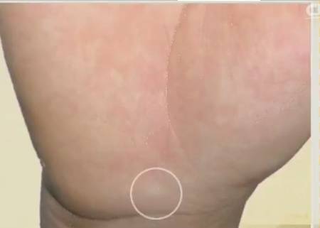 手上的健康秘密,手诊10种常见病从手上就能看出来