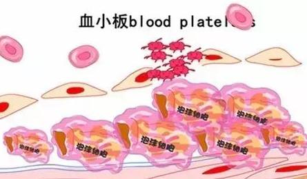 免疫性血小板减少症用激素副作用,血液病血小板减少症怎么治疗