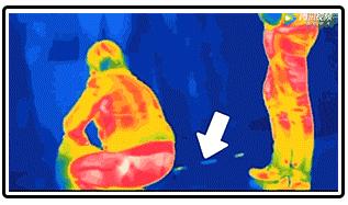 女朋友老是放屁臭,女人放屁多又臭用什么药来调理