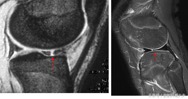看了这些图，才知道，其实足球是比较*力暴**的运动