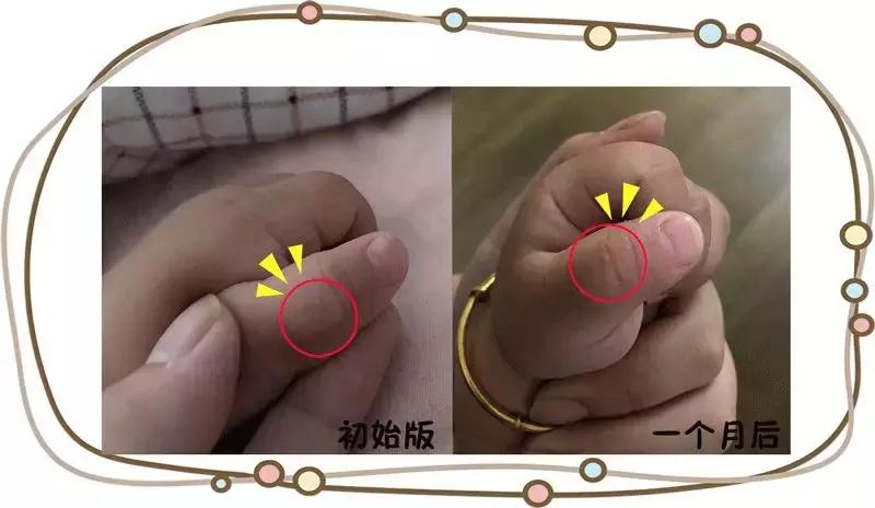 戒吃手神器管用吧,戒吃手的办法