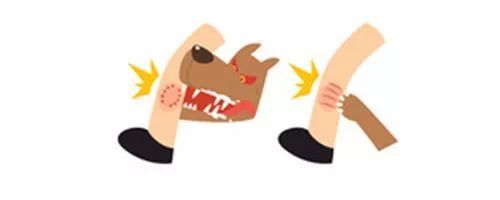 狂犬病致死率100%，这些救命知识一定要早知道！