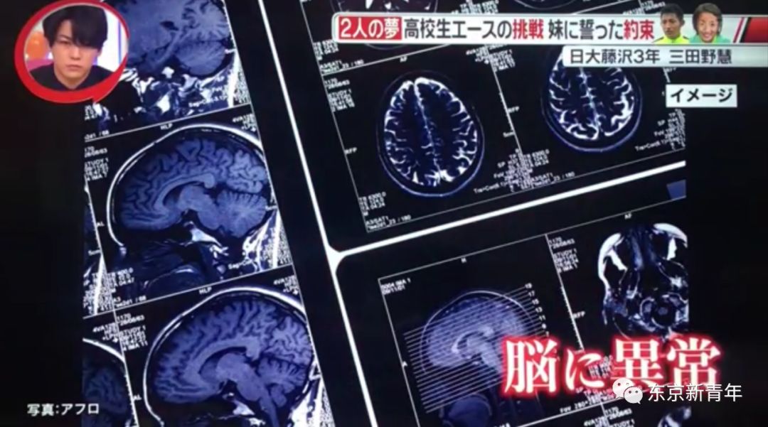 岛国小哥哥将妹妹的骨灰守在身边，发誓加入日本国家队，每天清晨5点起床练球……