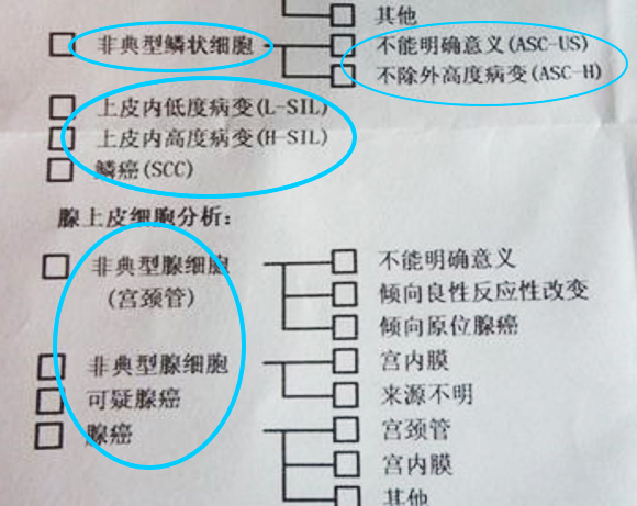 预防宫颈癌方法,预防宫颈癌最有效方法