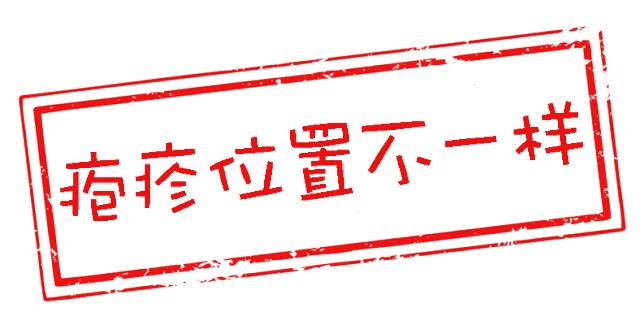 鉴别疱疹性咽峡炎和手足口病,疱疹性咽峡炎转成手足口了怎么办