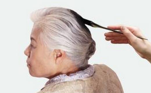 俏奶奶混用染发剂耳根长疱脸浮肿