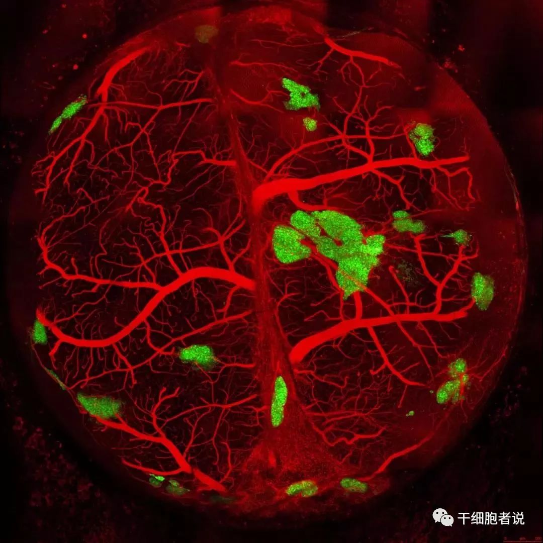 干细胞治疗一型糖尿病新进展,fda干细胞治疗一型糖尿病