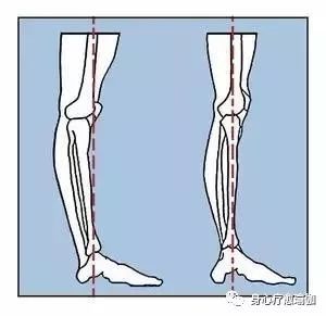 脚趾头无法弯曲怎么回事,脚趾不受控制是什么原因