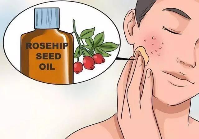 让毛孔变小用什么药,30几岁的皮肤毛孔粗能变小吗