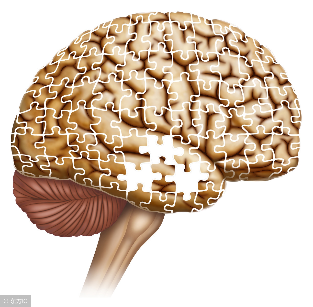 中医治疗小脑萎缩最佳方法,董氏奇穴治小脑萎缩的针灸