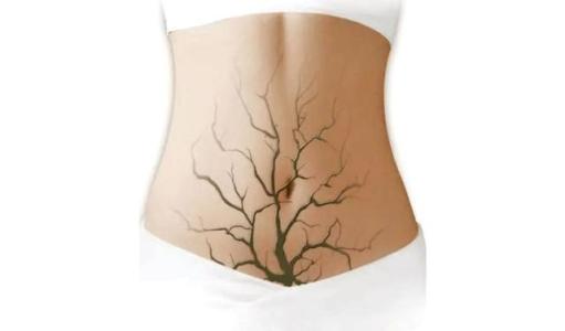 妇科疾病患者建议少吃这4种食物,有霉菌性妇科炎症可以吃哪些食物