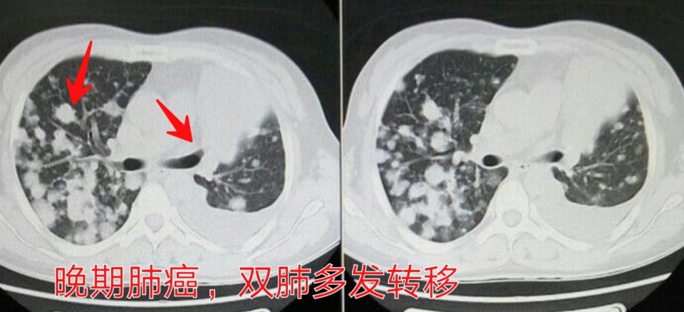 除了靶向免疫还有别的方法吗,除了靶向药还有什么方法治疗