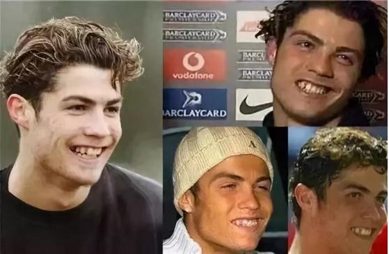 c罗整容过么,c罗整容了没