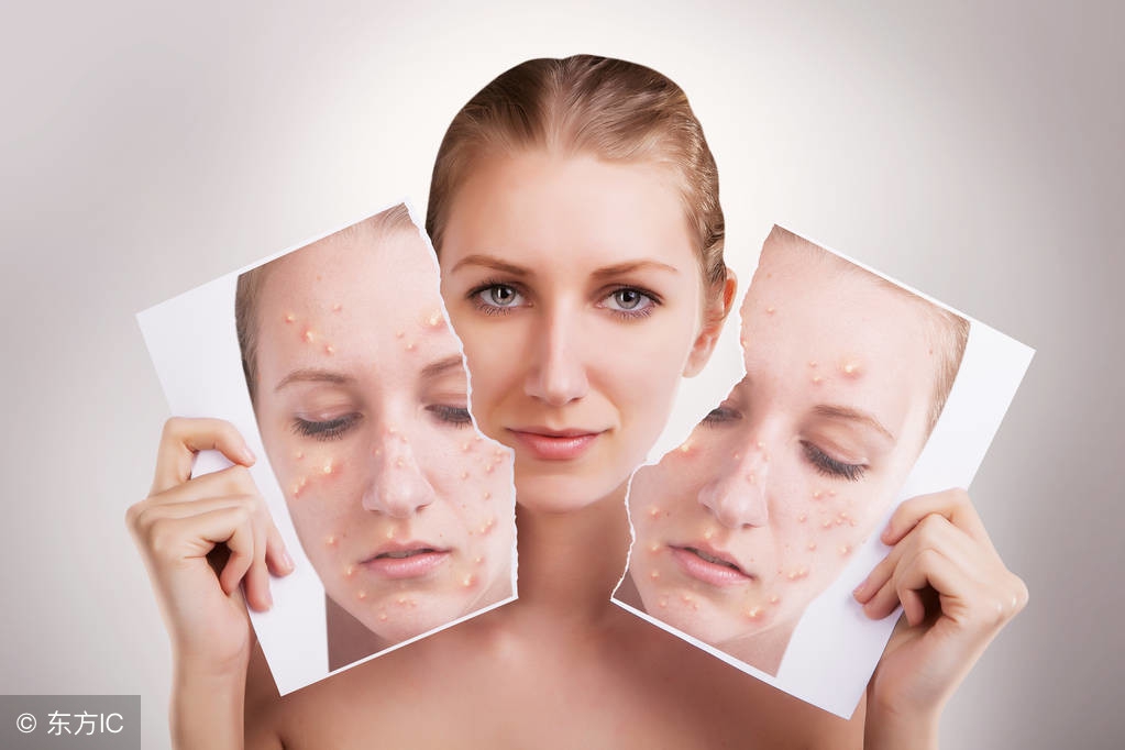 妇科健康小常识：如何发现尿*禁失**和子宫脱垂？早期该做哪些治疗？