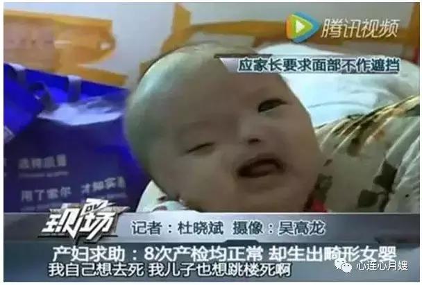 三级b超单看得清胎儿鼻子,产检三级和二级的区别