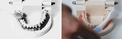 日本牙膏修复牙洞是真的吗,为什么日本人牙那么白