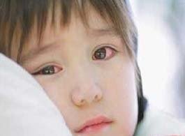 得了结膜炎可以自愈吗,春天过敏性结膜炎高发该怎么办