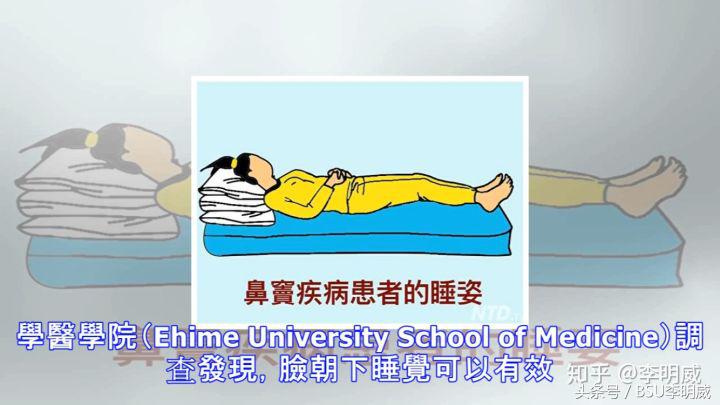 正确睡姿改善背痛,睡姿不好肩膀疼痛怎么改正