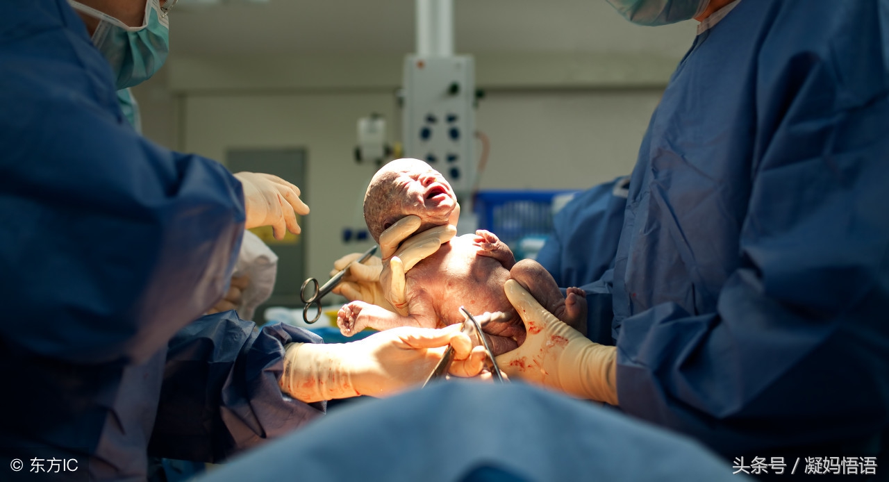 剖腹产是自己选择横切还是竖切,剖腹产可以自己选择时间剖么