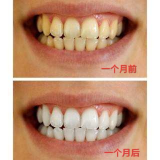 牙齿美白小贴士,美白牙膏真的能美白牙