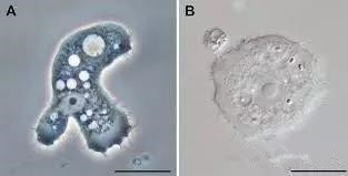 经常戴隐形眼镜有什么不好,为什么戴隐形眼镜一开始会辣眼睛