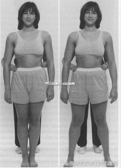 矫正长短腿去哪里矫正,体态矫正腿