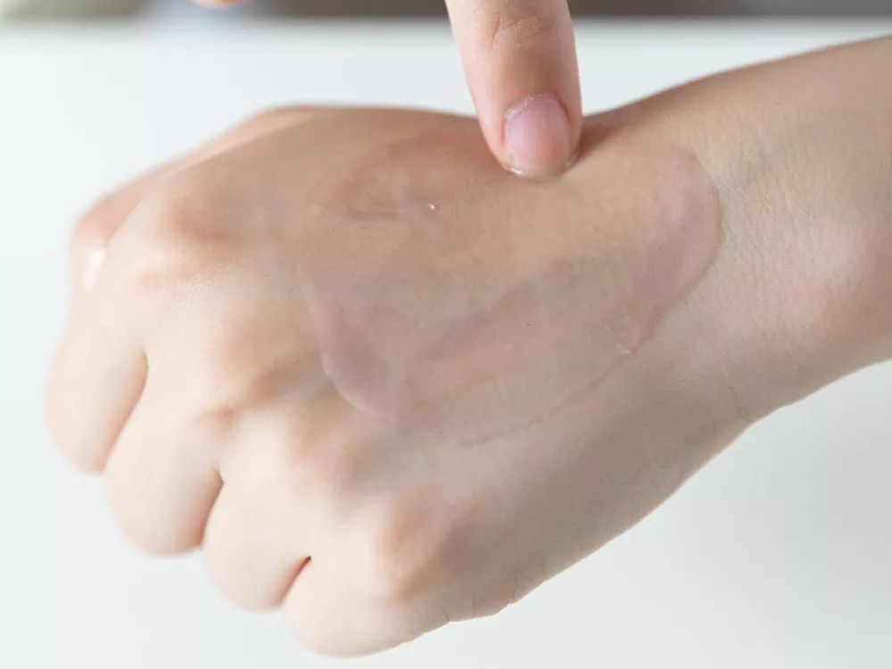 28天解决了所有皮肤问题，你猜我做了些什么？