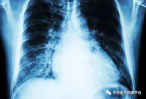 高血压停药的危害,高血压带来的危害有哪些