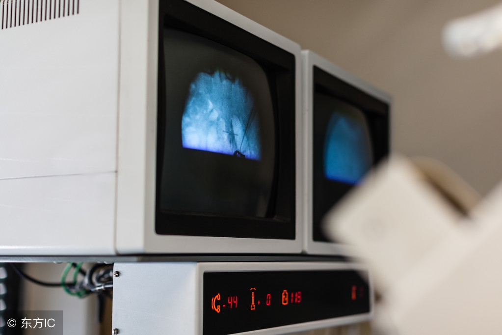 82岁老人肾内长巨石！如何将巨型结石一次性清理干净