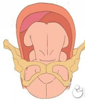 屁股大真的很容易生孩子吗,屁股大生儿子是什么原因