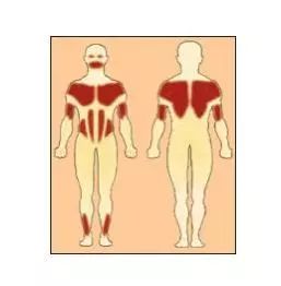 肌肉萎缩怎么诊断,肌肉萎缩属于重症肌无力么
