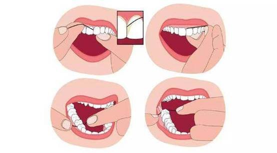 看牙太贵还不是因为你怕遭罪,不整牙有必要买冲牙器吗