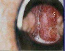 身体里长出白色虫子,身体上长小虫子都是什么虫