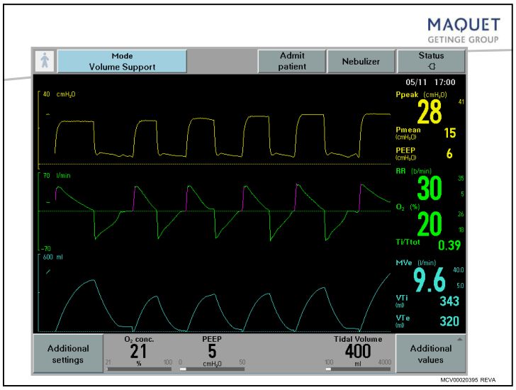 呼吸机模式和参数设置及临床意义,院前呼吸机模式及参数设置