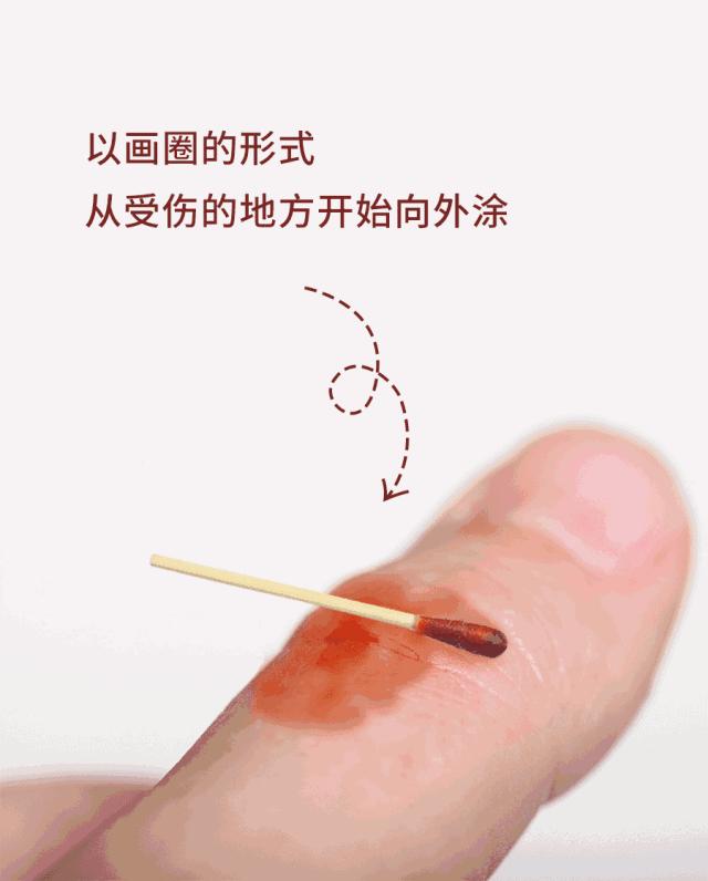 1分钟育儿｜宝宝烫伤、擦伤急救法