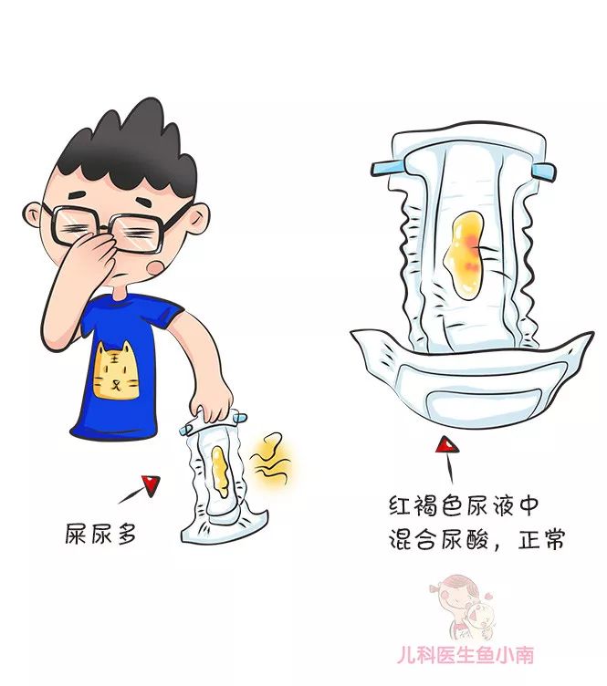 宝宝便便的健康信号,大便颜色看健康警报