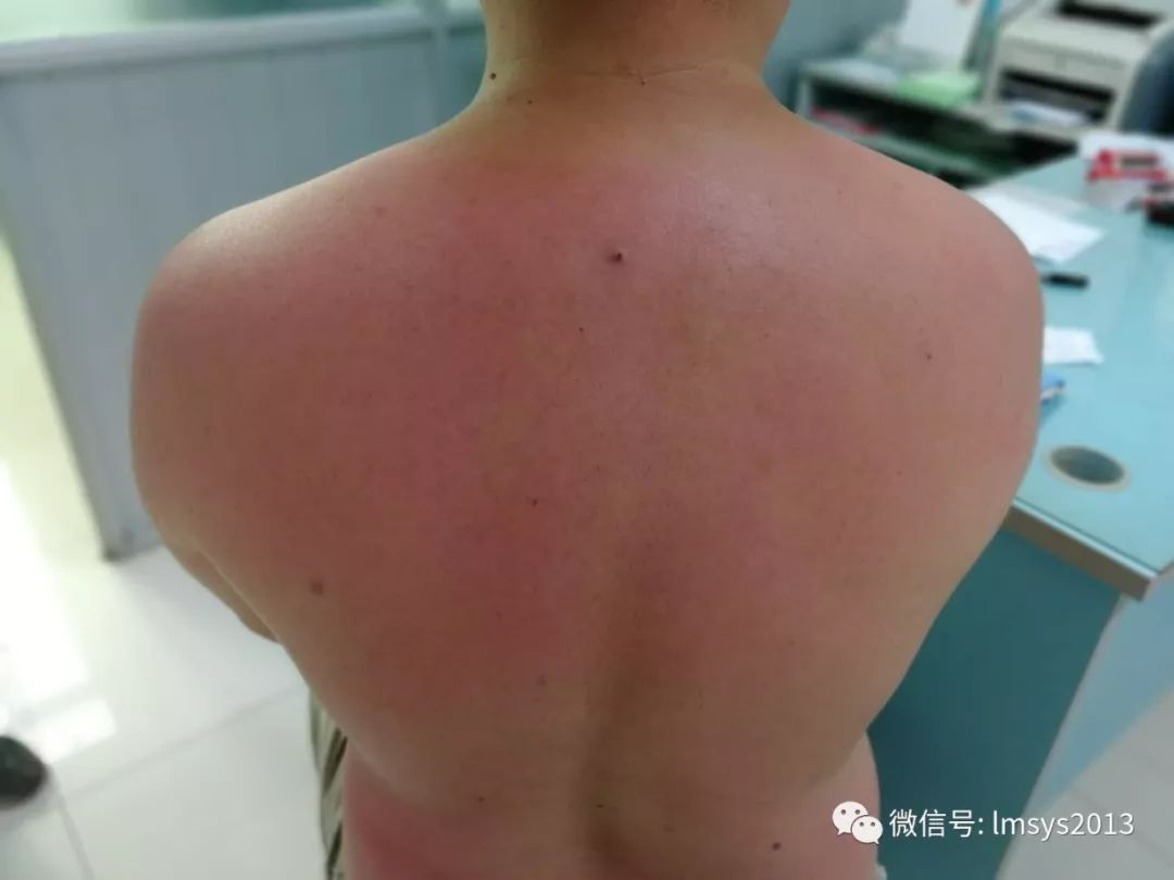 夏日旅游防晒必备推荐,暑假出游记防晒不可少